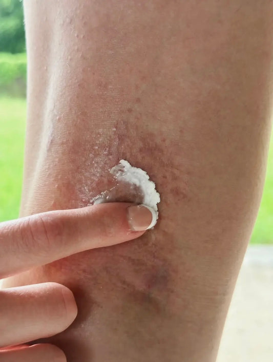 Lavender Thorne HONEY DEW (Skin Calming Salve)